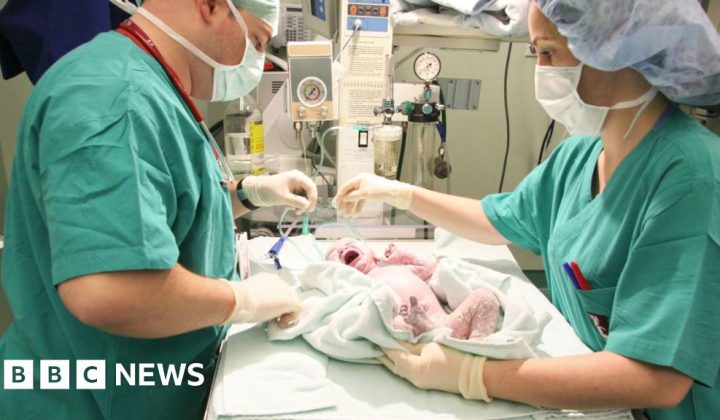 Emergency C-Sections Rise Sharply in England, Now One in Four Births