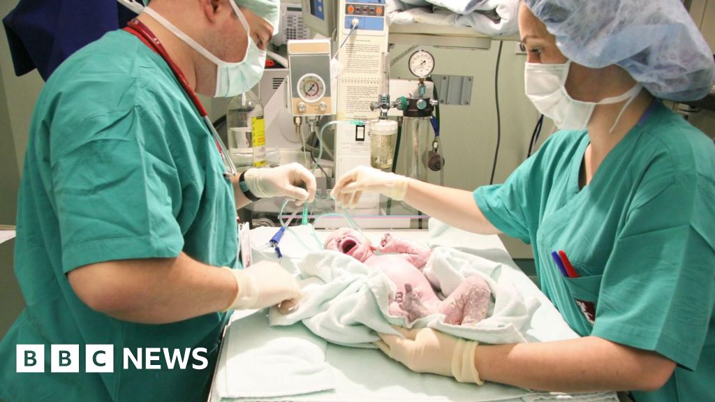 Emergency C-Sections Rise Sharply in England, Now One in Four Births